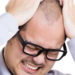 зуд скальпа