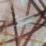 Перифоликулярная муфта