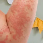 трихолог алматы