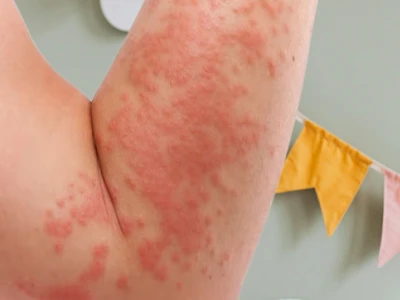 трихолог алматы